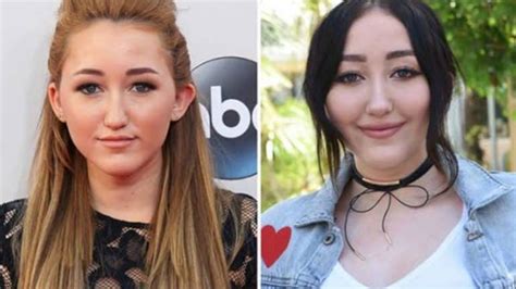 noah cyrus before after|Noah Cyrus’ Before & After Looks: The Hardest Part。